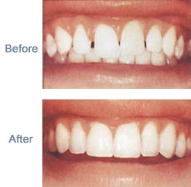 cosmetic dentistry