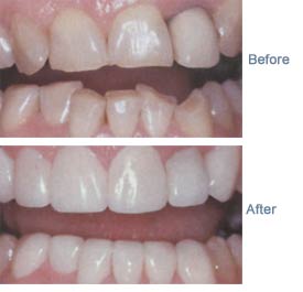 cosmetic dentistry